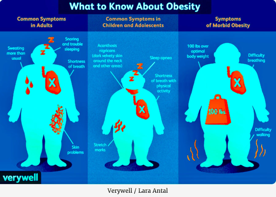 Obesity: Why Can’t I Lose Weight? - Blog # 58