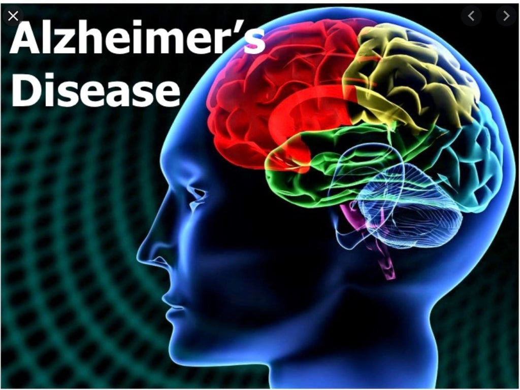 Alzheimer’s and EVOO - Blog # 34