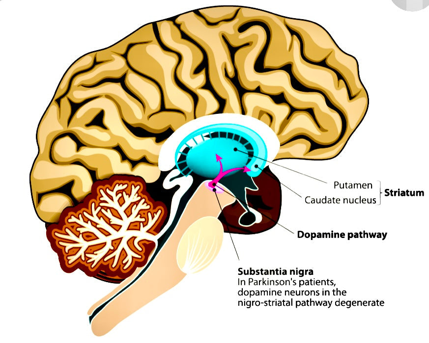 Parkinson’s and EVOO - Blog # 31